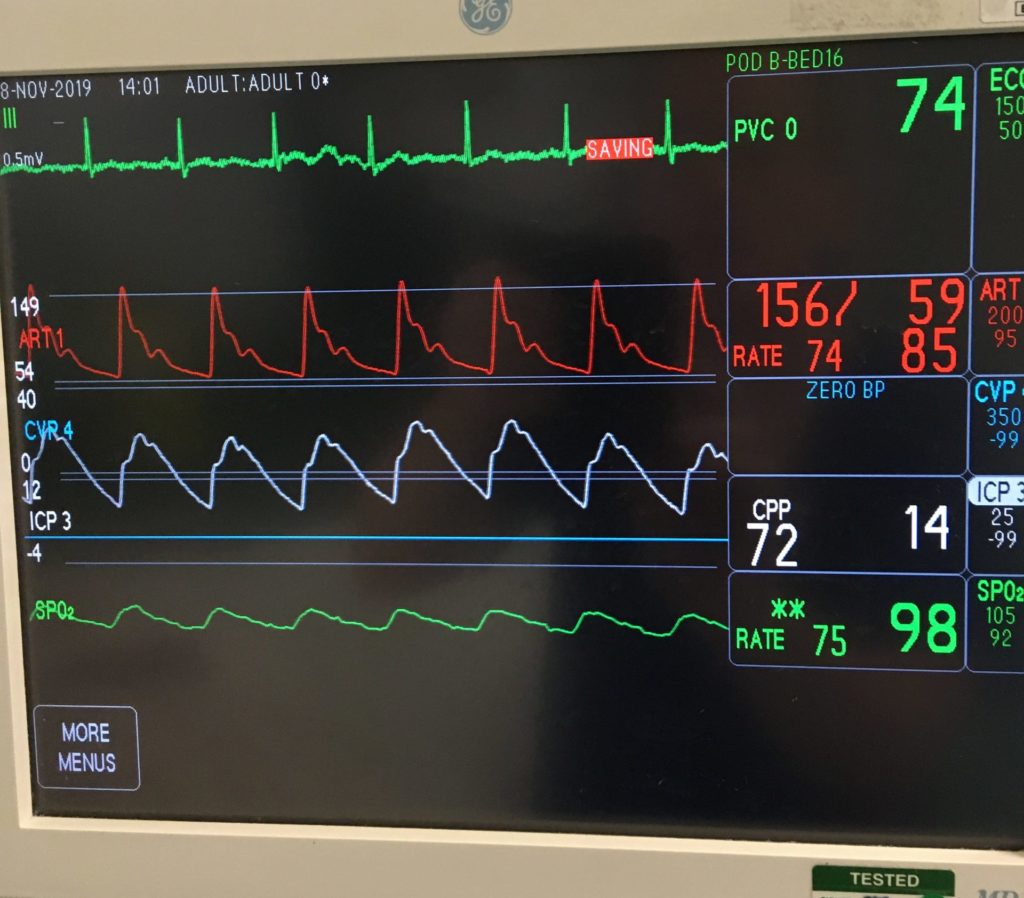 Equipment that you will see and hear in the Critical Care Unit ...